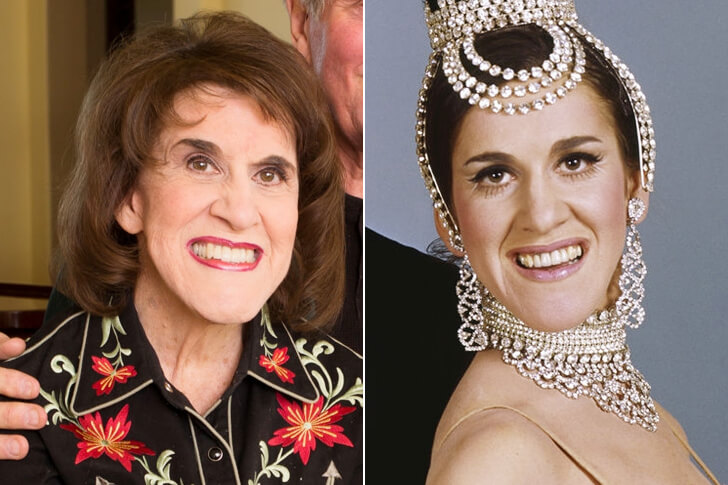 Long Forgotten Legendary Celebs You’ll Be Surprised Are Still Alive And