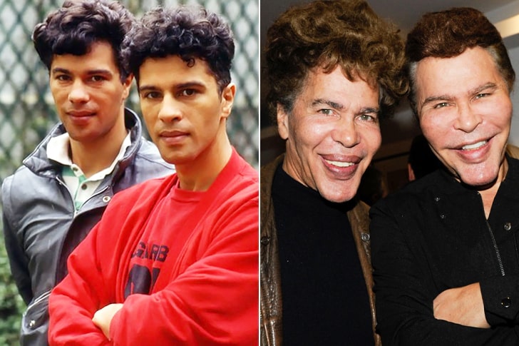 Les Frères Bogdanov Avant La Chirurgie Esthétique Les Frères Igor Et Grichka Bogdanov Avant Leur Transformation - Esam