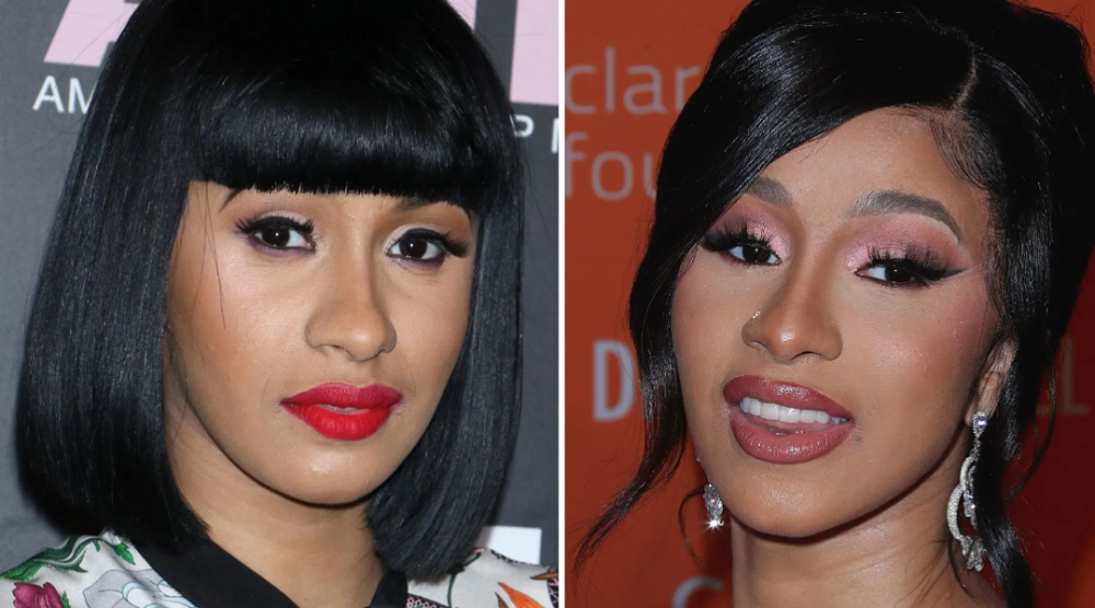 Cardi B before and after plastic surgery.